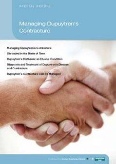 Managing Dupuytren's Contracture